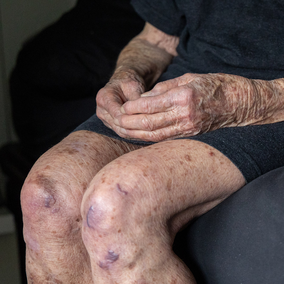 Het fotoproject Doorleefd van Ineke Wesselink verkent de schoonheid van imperfectie en vergankelijkheid.