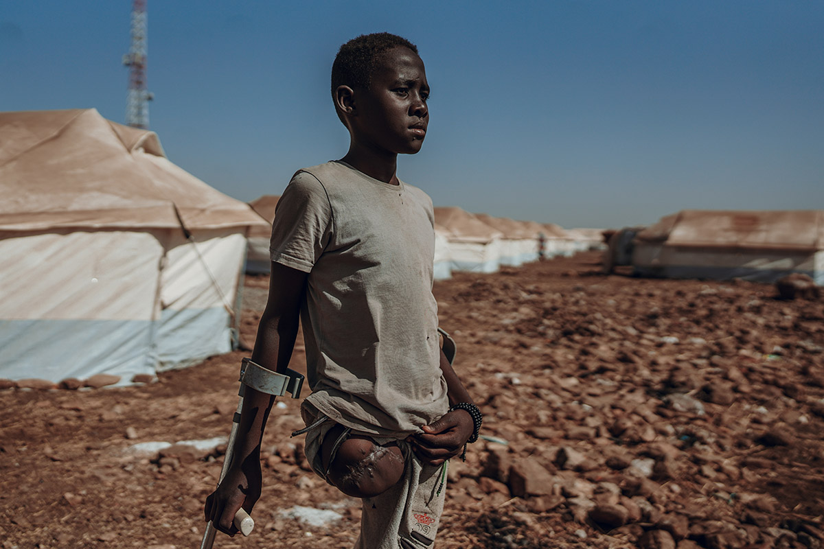 Gamareldin, Gedaref, Sudan<br>
Lieuwe Siebe de Jong - 2024<br>
De dertienjarige Gamareldin was met zijn broer buiten aan het spelen in de Sudanese hoofdstad Khartoem toen een bom hen trof. Hij verloor in één klap zijn been. Zijn negenjarige broertje raakte verlamd toen een granaatscherf zijn lichaam doorboorde. Na behandeling in Wad Madani moesten ze opnieuw vluchten. Gamareldin krukte drie uur lang over de gevaarlijke frontlinie en arriveerde kortgeleden in een vluchtelingenkamp in Alhoori. ZOA verstrekt daar warme maaltijden aan alle nieuwkomers in dit kamp.