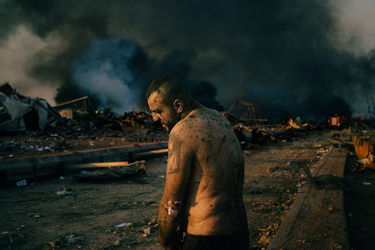 World Press Photo of the Year Nominee, Lorenzo Tugnoli, Italy, Contrasto for The Washington Post, Injured Man After Port Explosion in Beirut. An injured man stands near the site of a massive explosion in the port of Beirut, Lebanon, while firefighters work to put out the fires that engulfed the warehouses after the explosion, on 4 August.